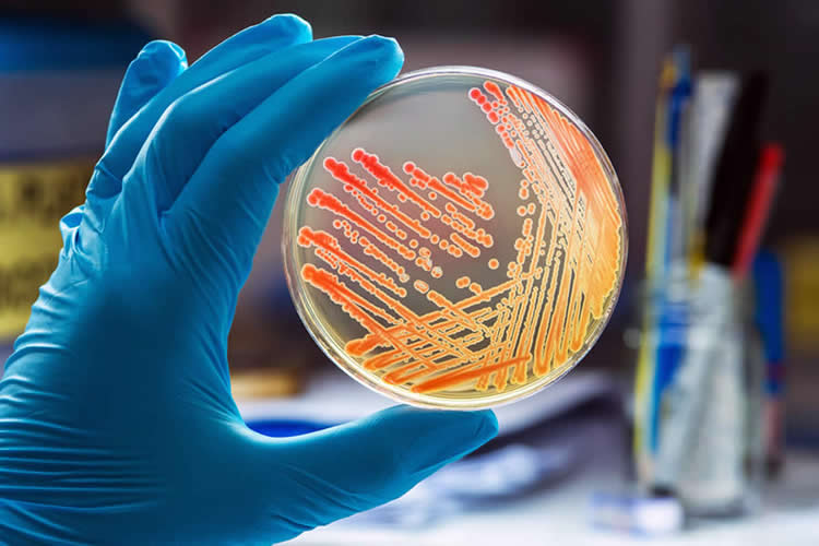 Analisi acque potabili Verbania, ricerca Legionella spp,  pneumophila, microbiologiche, chimiche, campionamento, consulenze e manuali HCCP